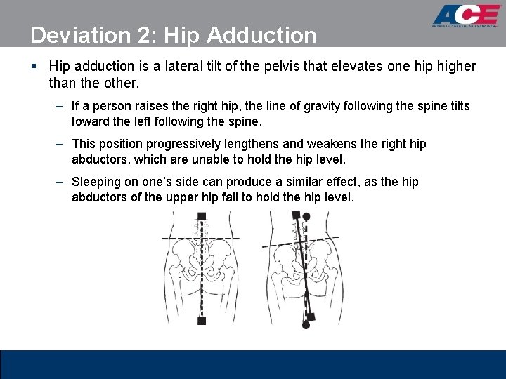 Deviation 2: Hip Adduction § Hip adduction is a lateral tilt of the pelvis