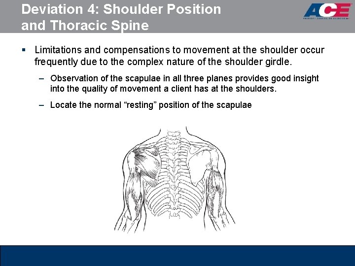 Deviation 4: Shoulder Position and Thoracic Spine § Limitations and compensations to movement at