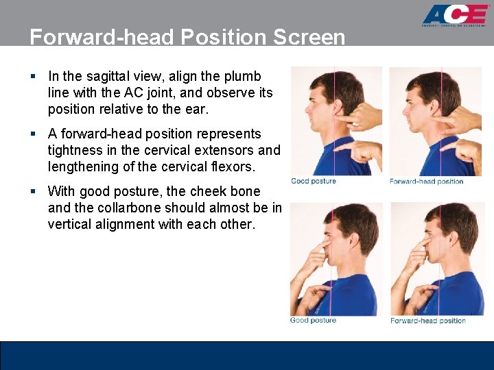 Forward-head Position Screen § In the sagittal view, align the plumb line with the