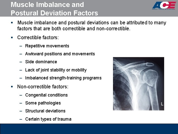 Muscle Imbalance and Postural Deviation Factors § Muscle imbalance and postural deviations can be