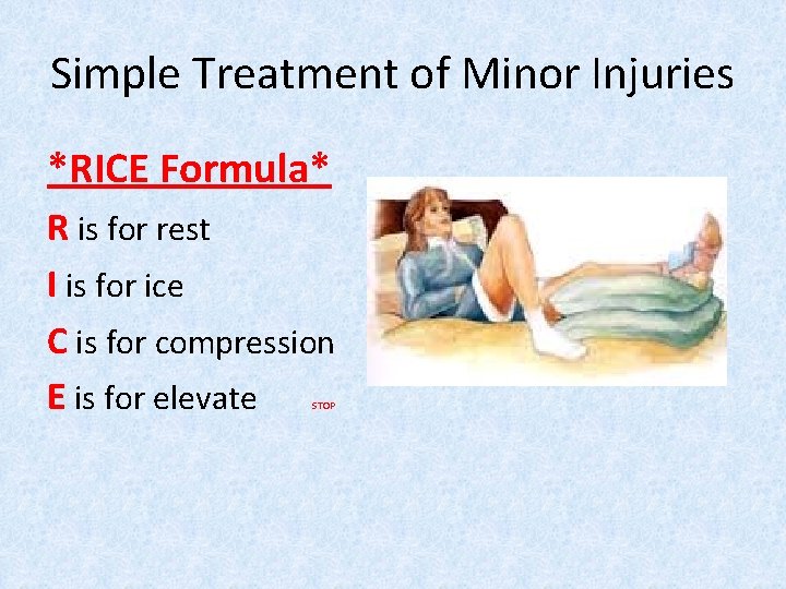 Simple Treatment of Minor Injuries *RICE Formula* R is for rest I is for Simple Treatment of Minor Injuries *RICE Formula* R is for rest I is for