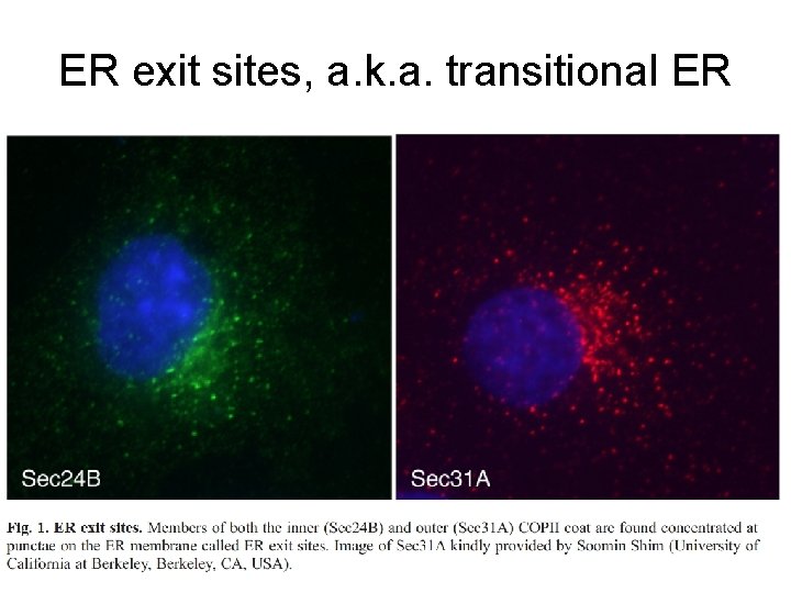 ER exit sites, a. k. a. transitional ER 