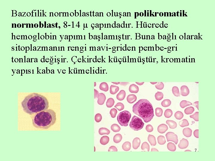 Bazofilik normoblasttan oluşan polikromatik normoblast, 8 -14 µ çapındadır. Hücrede hemoglobin yapımı başlamıştır. Buna