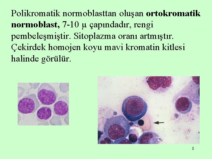 Polikromatik normoblasttan oluşan ortokromatik normoblast, 7 -10 µ çapındadır, rengi pembeleşmiştir. Sitoplazma oranı artmıştır.