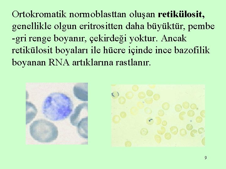 Ortokromatik normoblasttan oluşan retikülosit, genellikle olgun eritrositten daha büyüktür, pembe -gri renge boyanır, çekirdeği