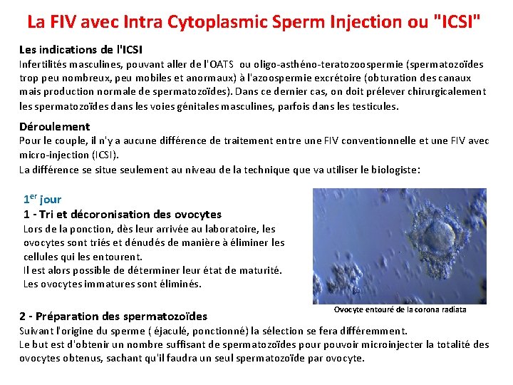 La FIV avec Intra Cytoplasmic Sperm Injection ou "ICSI" Les indications de l'ICSI Infertilités