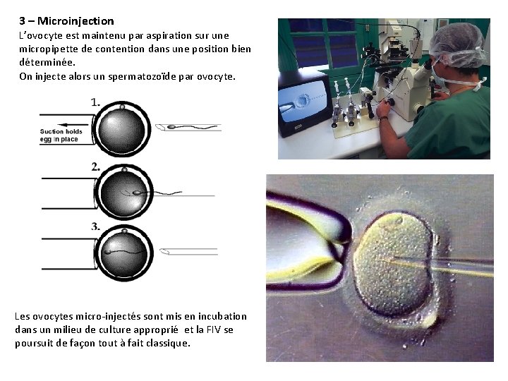 3 – Microinjection L’ovocyte est maintenu par aspiration sur une micropipette de contention dans