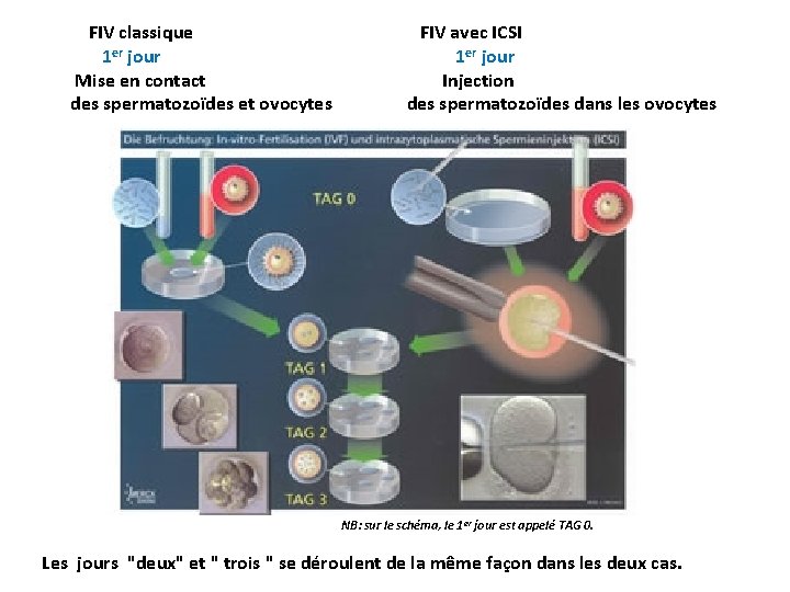  FIV classique 1 er jour Mise en contact des spermatozoïdes et ovocytes FIV
