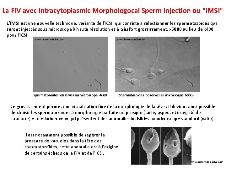 La FIV avec Intracytoplasmic Morphologocal Sperm Injection ou "IMSI" L’IMSI est une nouvelle technique,