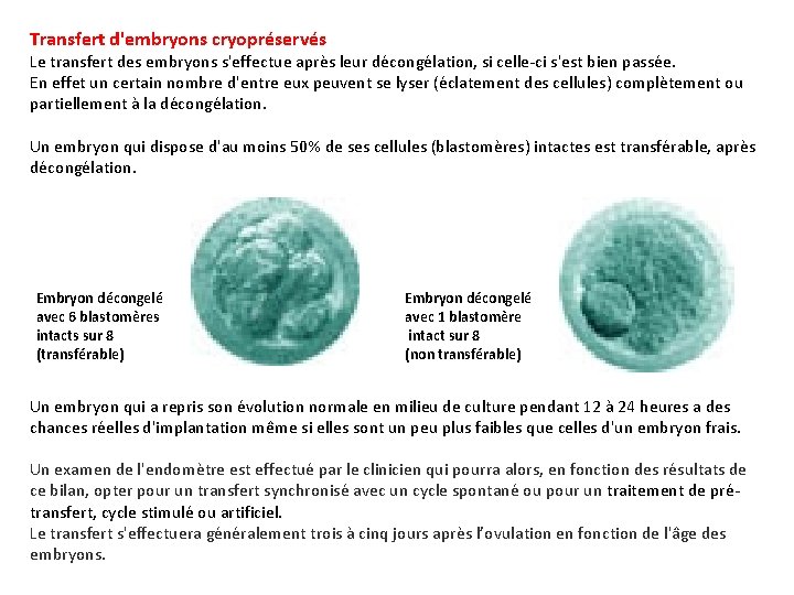 Transfert d'embryons cryopréservés Le transfert des embryons s'effectue après leur décongélation, si celle-ci s'est