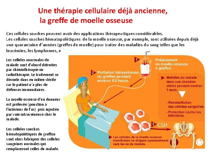 Une thérapie cellulaire déjà ancienne, la greffe de moelle osseuse Ces cellules souches peuvent