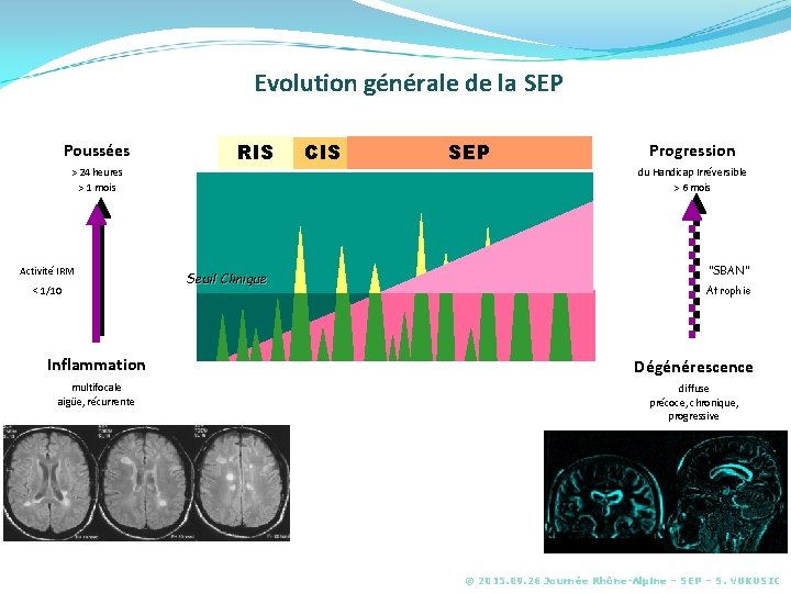 Evolution générale de la SEP Poussées RIS > 24 heures > 1 mois Activité