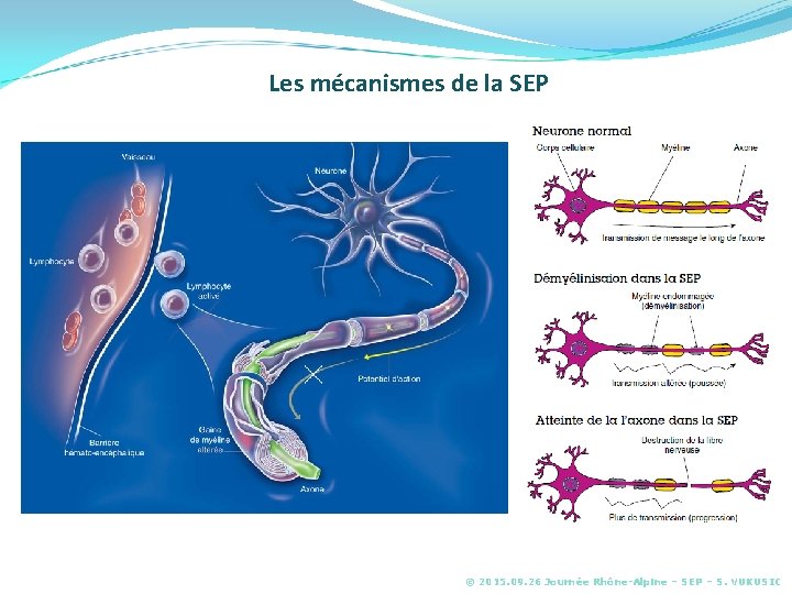 Les mécanismes de la SEP © 2015. 09. 26 Journée Rhône-Alpine – SEP –