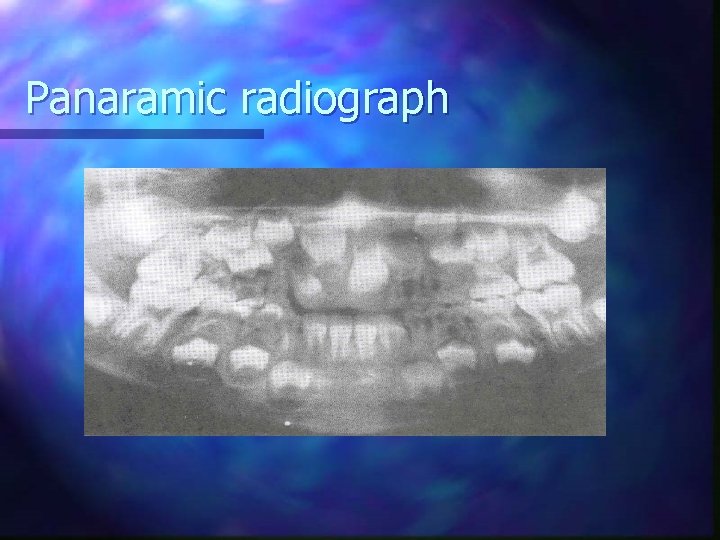Panaramic radiograph 