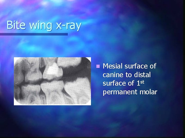 Bite wing x-ray n Mesial surface of canine to distal surface of 1 st