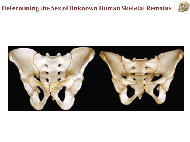 Determining the Sex of Unknown Human Skeletal Remains 