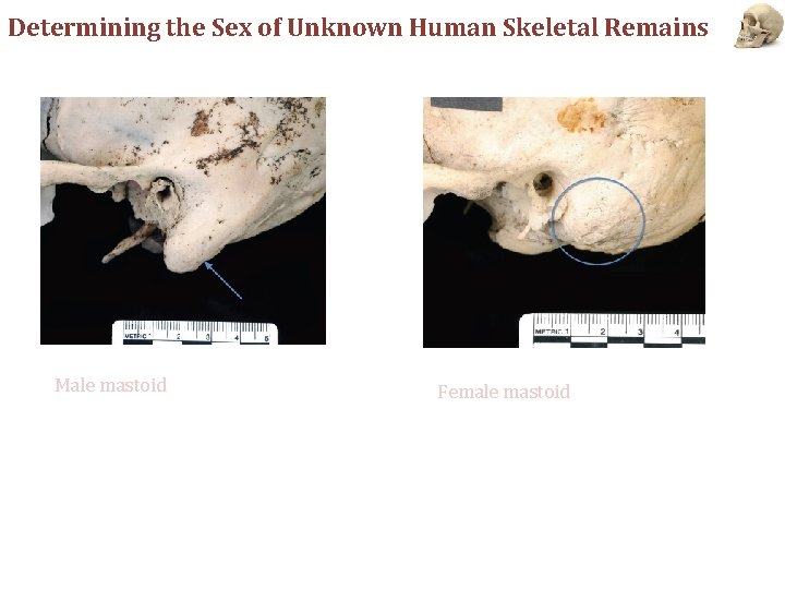 Determining the Sex of Unknown Human Skeletal Remains Male mastoid Female mastoid 