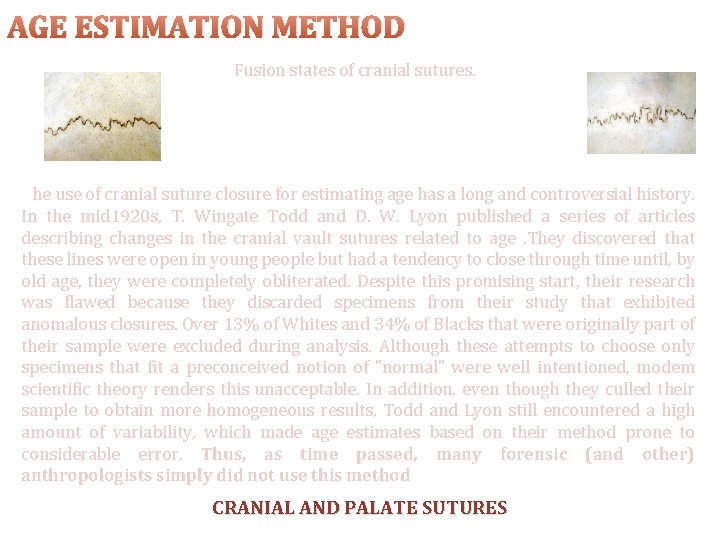 AGE ESTIMATION METHOD Fusion states of cranial sutures. . The use of cranial suture