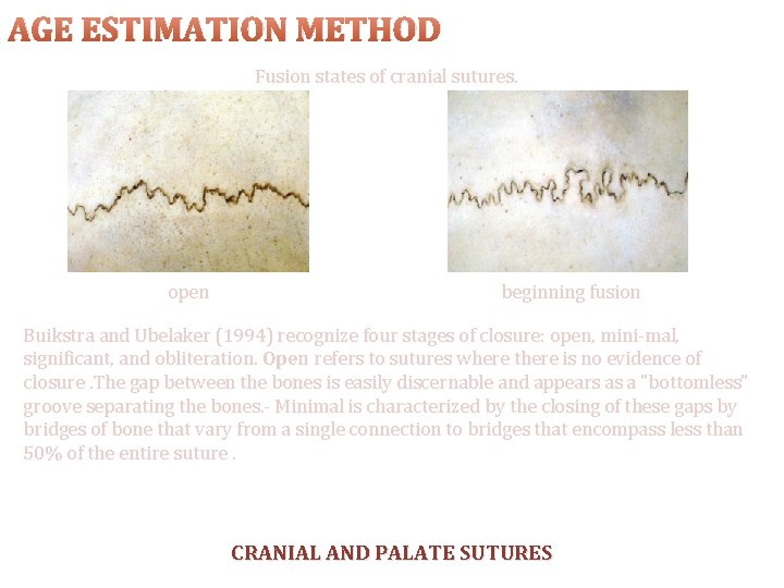 AGE ESTIMATION METHOD Fusion states of cranial sutures. open beginning fusion Buikstra and Ubelaker