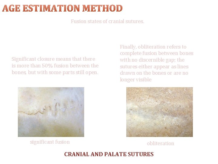 AGE ESTIMATION METHOD Fusion states of cranial sutures. Significant closure means that there is