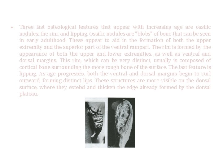  • Three last osteological features that appear with increasing age are ossific nodules,