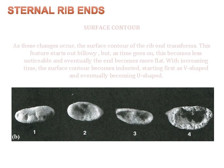 STERNAL RIB ENDS SURFACE CONTOUR As these changes occur, the surface contour of the