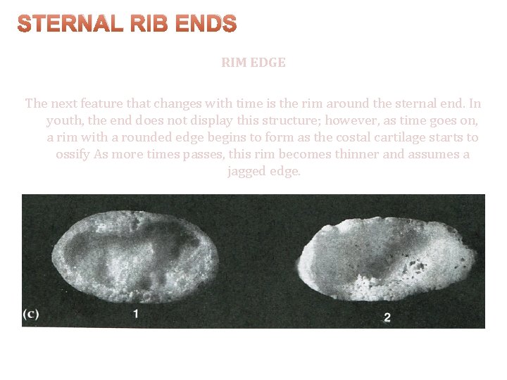 STERNAL RIB ENDS RIM EDGE The next feature that changes with time is the