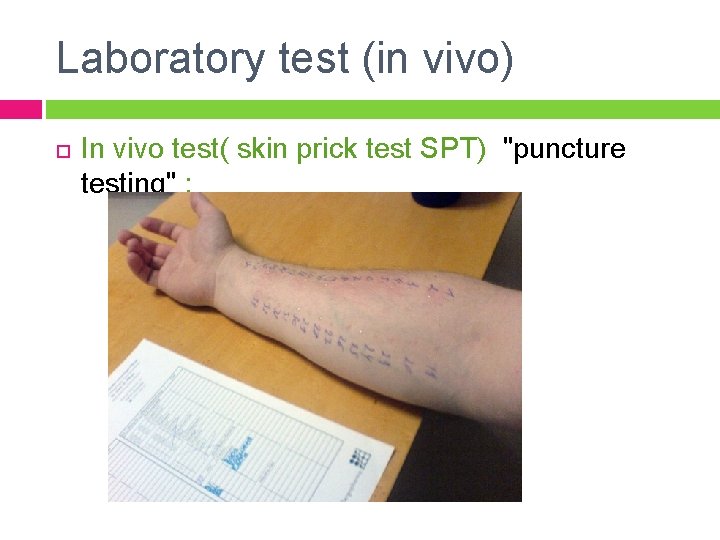 Laboratory test (in vivo) In vivo test( skin prick test SPT) "puncture testing" :