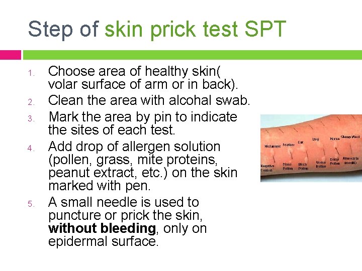 Step of skin prick test SPT 1. 2. 3. 4. 5. Choose area of