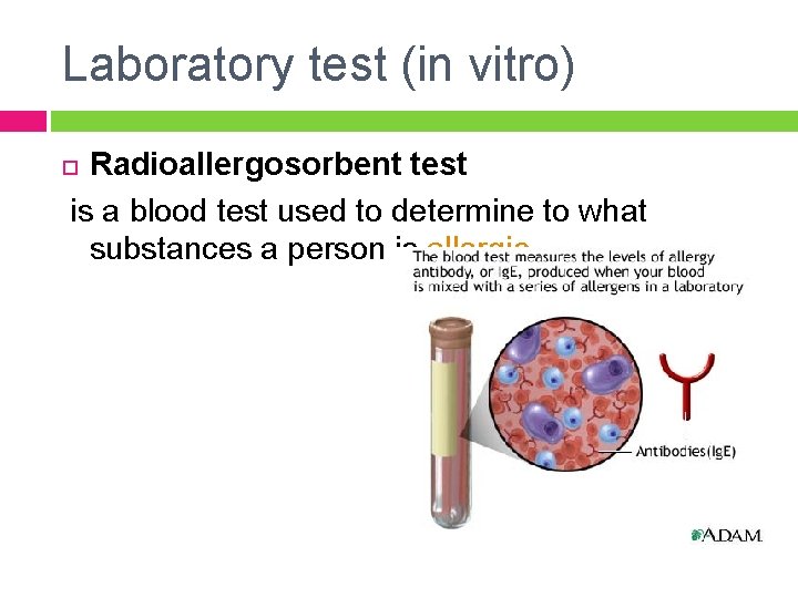 Laboratory test (in vitro) Radioallergosorbent test is a blood test used to determine to