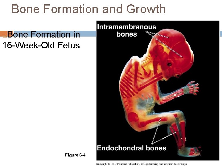 Bone Formation and Growth Bone Formation in 16 -Week-Old Fetus Figure 6 -4 