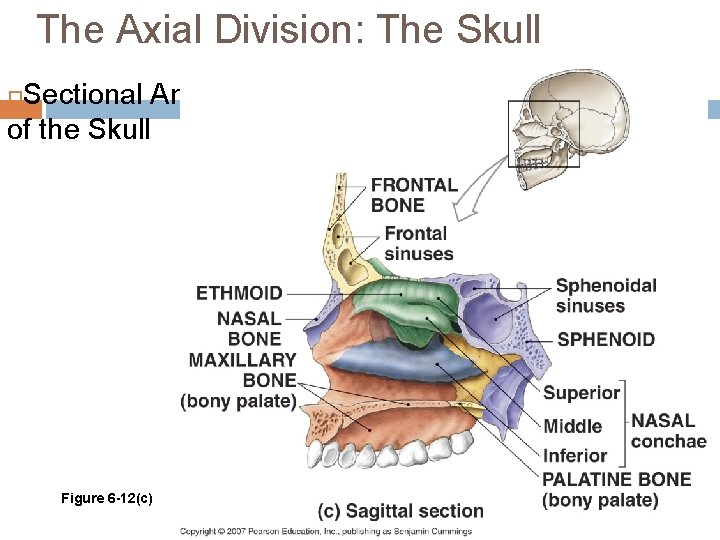 The Axial Division: The Skull Sectional Anatomy of the Skull Figure 6 -12(c) 