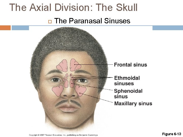 The Axial Division: The Skull The Paranasal Sinuses Figure 6 -13 