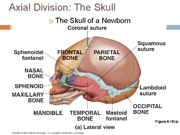 Axial Division: The Skull of a Newborn Figure 6 -15(a) 