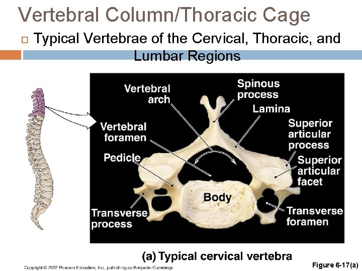 Vertebral Column/Thoracic Cage Typical Vertebrae of the Cervical, Thoracic, and Lumbar Regions Figure 6