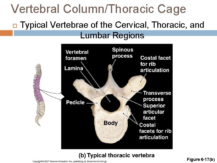 Vertebral Column/Thoracic Cage Typical Vertebrae of the Cervical, Thoracic, and Lumbar Regions Figure 6