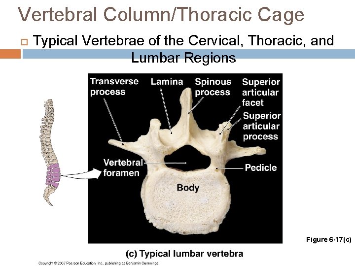 Vertebral Column/Thoracic Cage Typical Vertebrae of the Cervical, Thoracic, and Lumbar Regions Figure 6