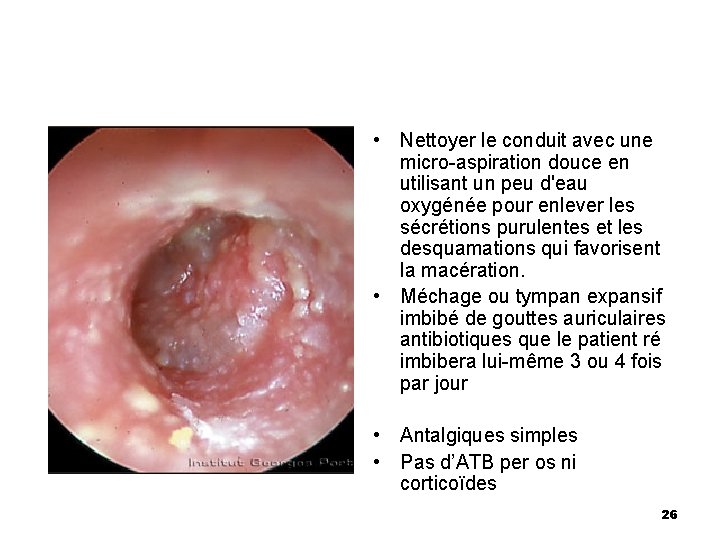 • Nettoyer le conduit avec une micro-aspiration douce en utilisant un peu d'eau • Nettoyer le conduit avec une micro-aspiration douce en utilisant un peu d'eau