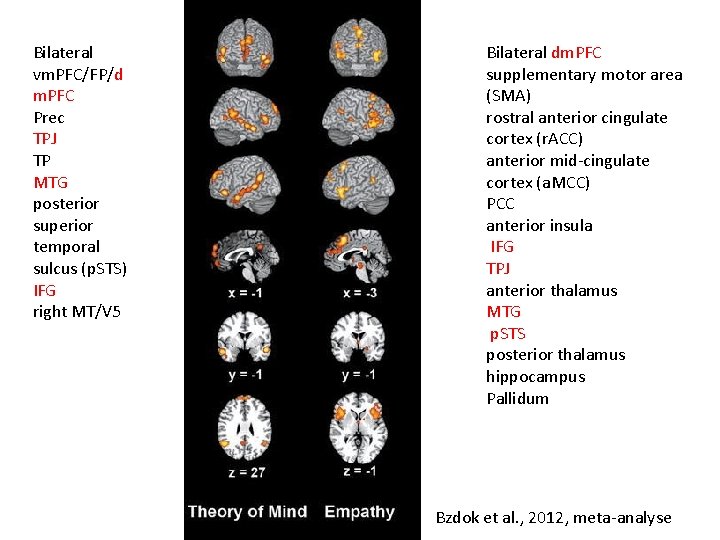 Bilateral vm. PFC/FP/d m. PFC Prec TPJ TP MTG posterior superior temporal sulcus (p.