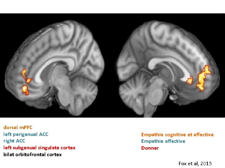 dorsal m. PFC left perigenual ACC right ACC left subgenual cingulate cortex bilat orbitofrontal