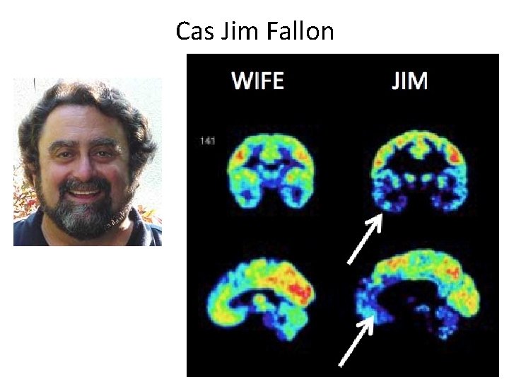 Cas Jim Fallon 