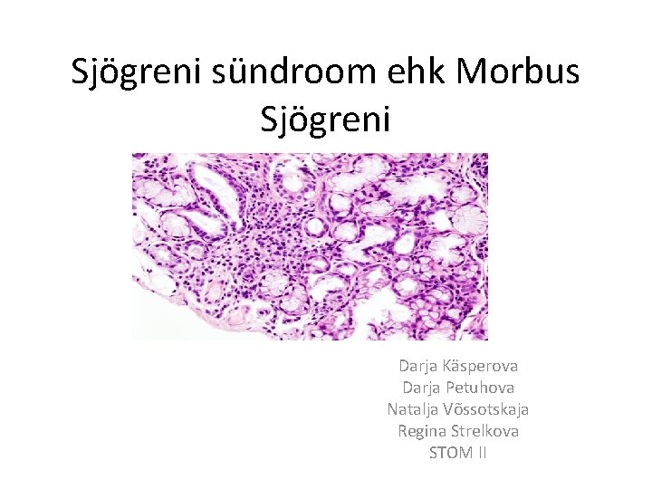 Sjögreni sündroom ehk Morbus Sjögreni Darja Käsperova Darja Petuhova Natalja Võssotskaja Regina Strelkova STOM