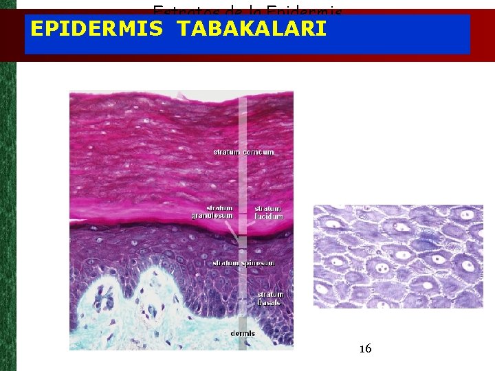 Estratos de la Epidermis EPIDERMIS TABAKALARI 16 