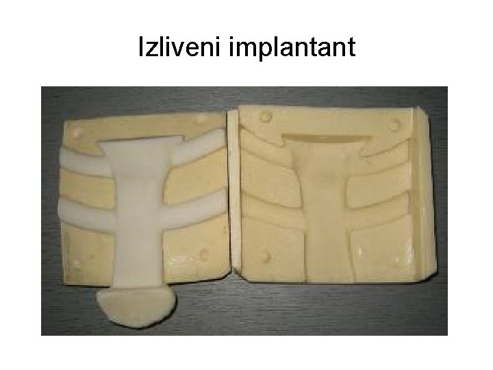 Izliveni implantant 