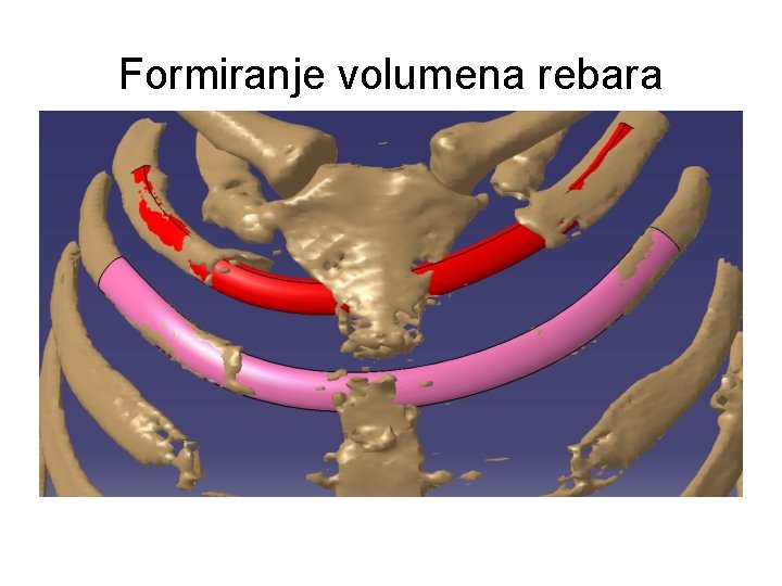 Formiranje volumena rebara 