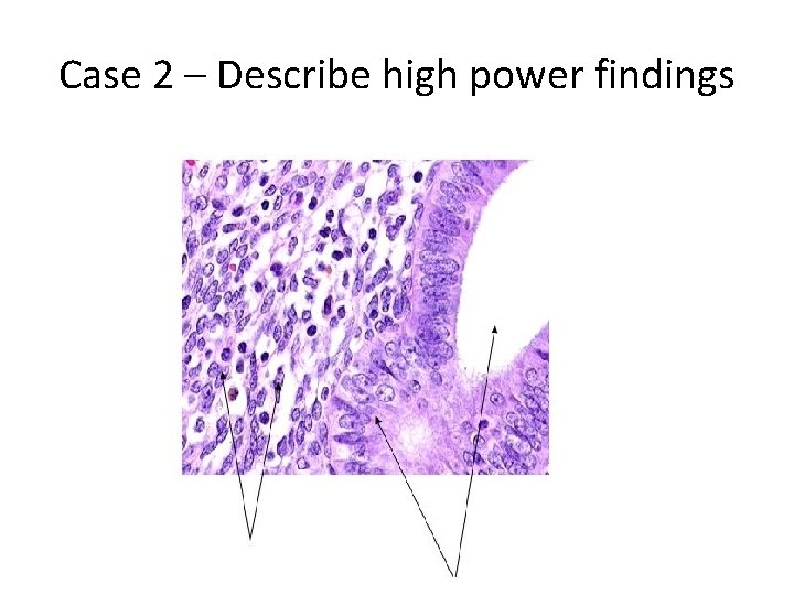 Case 2 – Describe high power findings 