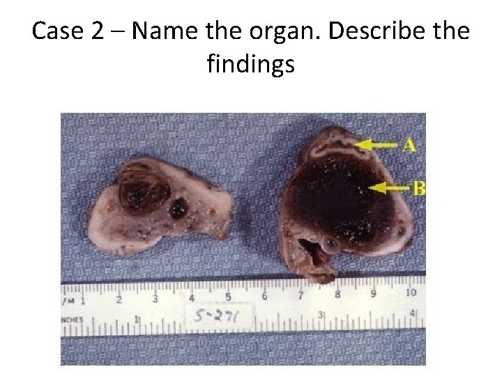 Case 2 – Name the organ. Describe the findings 