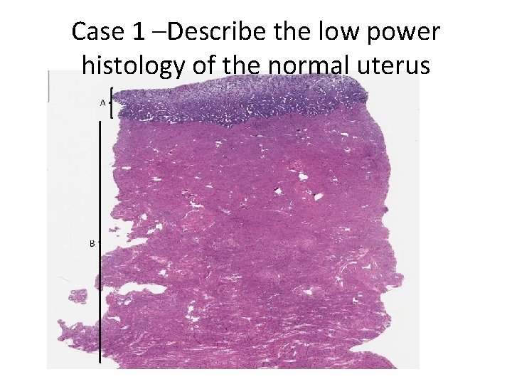 Case 1 –Describe the low power histology of the normal uterus 