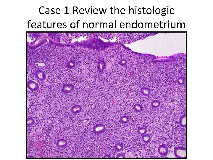 Case 1 Review the histologic features of normal endometrium 