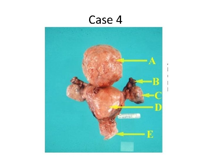 Case 4 